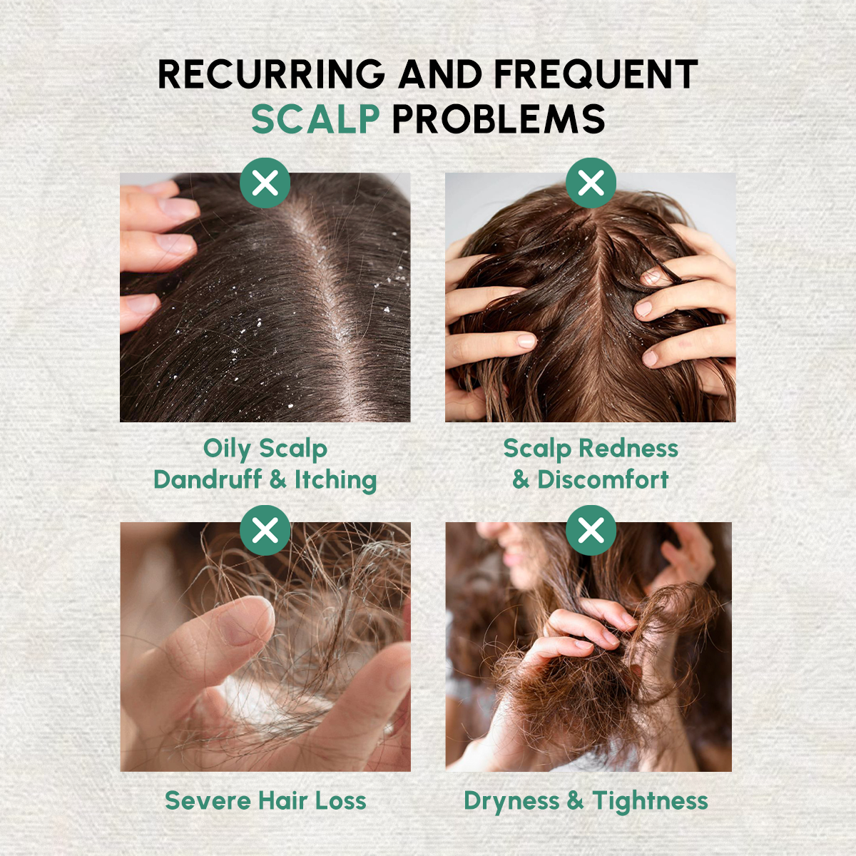 Botanical Hair Growth Serum – Treatment for Thinning Hair & Hair Loss 30 ml/1 fl. oz