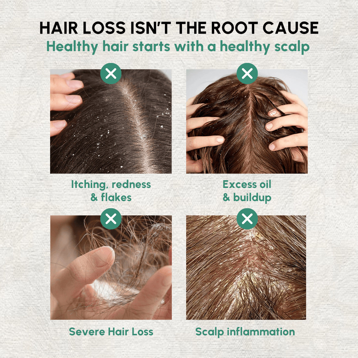 Botanical Thickening + Collagen Scalp Repair Shampoo Set